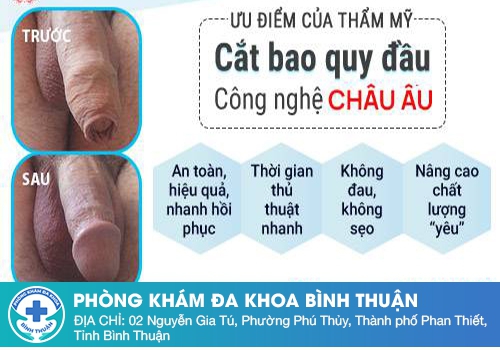 Những ưu điểm của phương cắt bao quy đầu bằng kỹ thuật xâm lấn tối thiểu