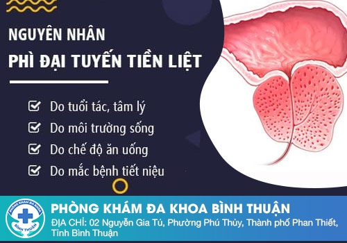 Nguyên nhân phì đại tuyến tiền liệt