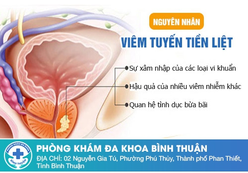 Nguyên nhân gây ra bệnh viêm tuyến tiền liệt