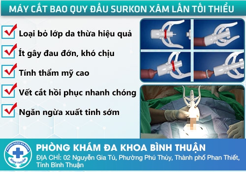 Phương pháp cắt bao quy đầu bằng kỹ thuật xâm lấn tối thiểu