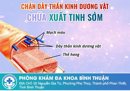 Cách điều trị xuất tinh sớm hiệu quả