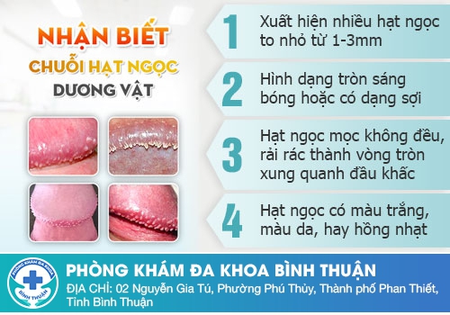 Hạt ngọc dương vật là gì?