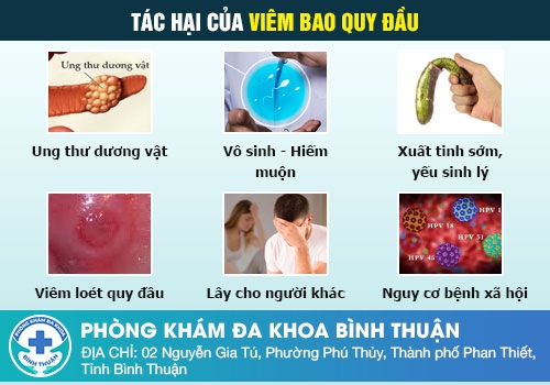 Những bệnh bao quy đầu thường gặp ở nam giới