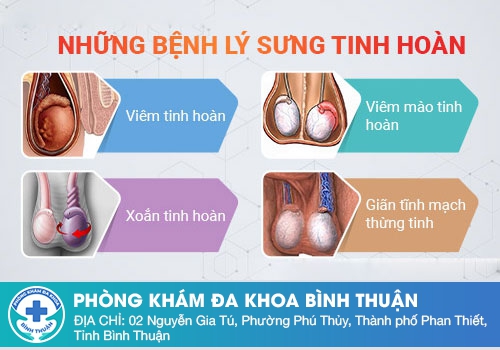 Cảnh giác với triệu chứng sưng tinh hoàn ở nam giới