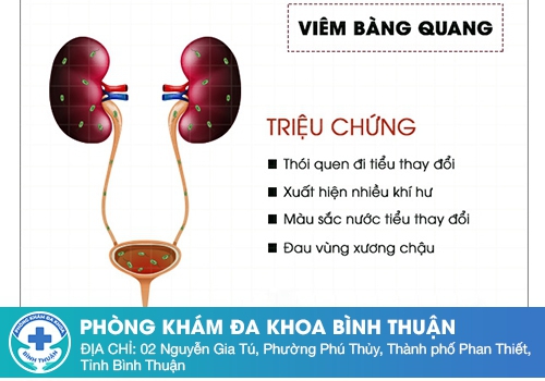 Triệu chứng viêm bàng quang