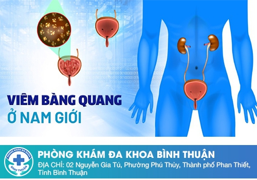 Nguyên nhân gây ra viêm bàng quang