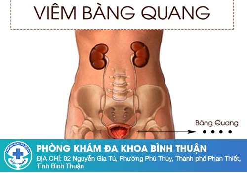 Viêm bàng quang là bệnh gì?