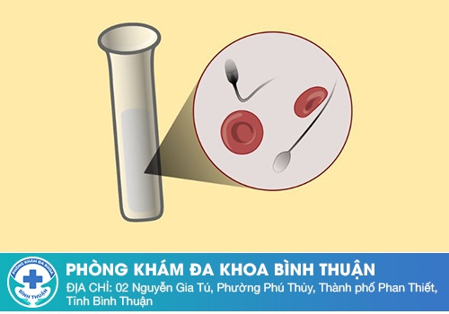 Tác hại của xuất tinh ra máu