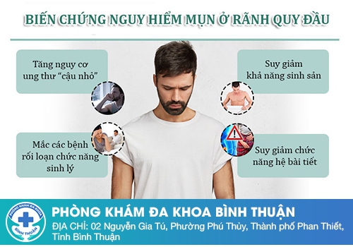 Chuỗi hạt ngọc dương vật có nguy hiểm không?