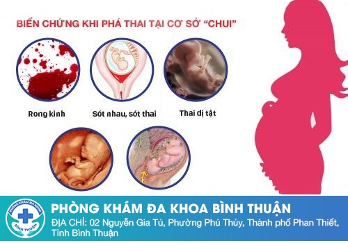 Có nên tự ý mua thuốc phá thai?