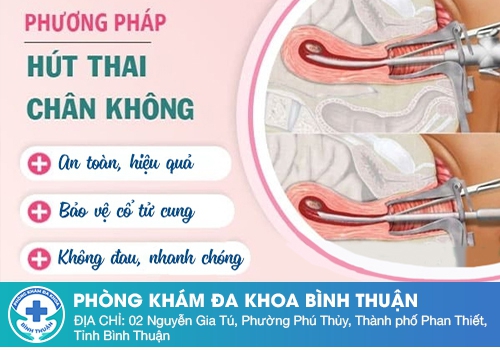 Các phương pháp đình chỉ thai 2 tháng tuổi an toàn, hiệu quả