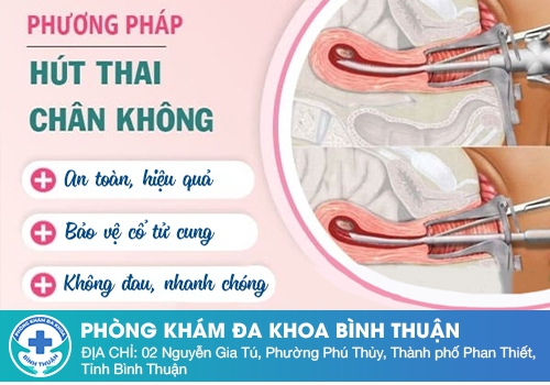 Các phương pháp phá thai theo tuần an toàn