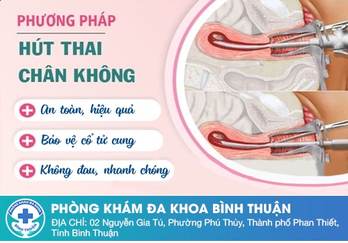 Cách bỏ thai an toàn bằng phương pháp hút thai chân không