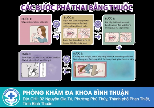 Quy trình phá thai bằng thuốc như thế nào?