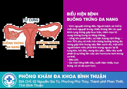 Nguyên nhân dẫn đến tình trạng trễ kinh là gì?