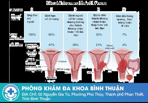 Nổi mụn cứng vùng kín không đau ở nữ giới là bệnh gì?