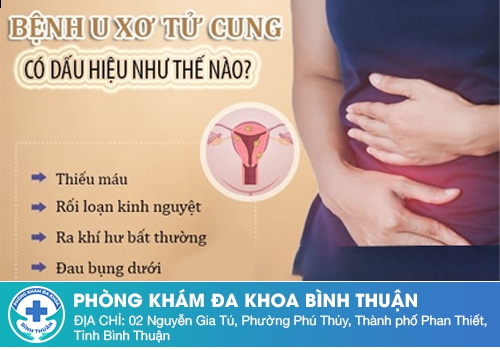 Khí hư màu trắng đục do u xơ tử cung