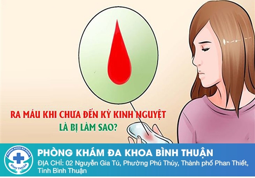 Chảy máu âm đạo nhưng không phải kinh nguyệt là do đâu?