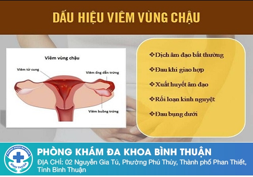 Chua âm đạo do viêm vùng chậu