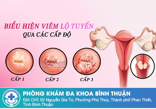 Nguyên nhân ra dịch âm đạo đen là do đâu?