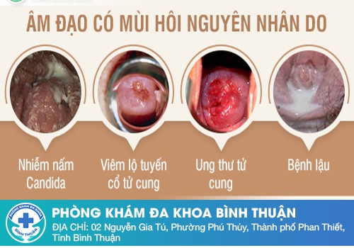 Nguyên nhân gây ra tình trạng hôi vùng kín là gì?