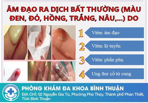 Khí hư mùi hôi tanh nguyên nhân do đâu