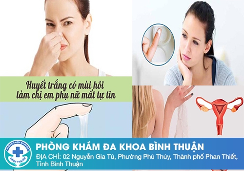 Nguyên nhân huyết trắng có mùi hôi là gì?