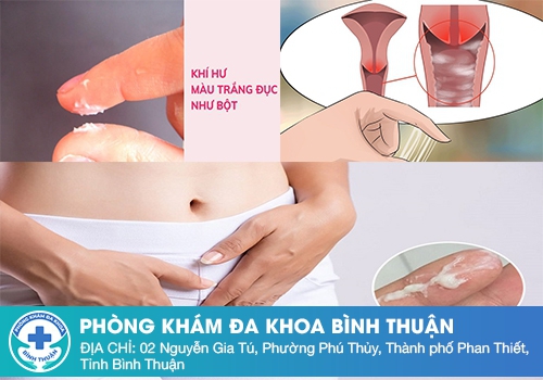 Nguyên nhân dẫn đến tình trạng huyết trắng bột