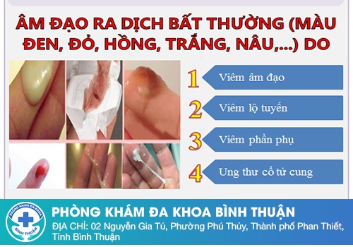 Nguyên nhân ra dịch âm đạo đen là do đâu?