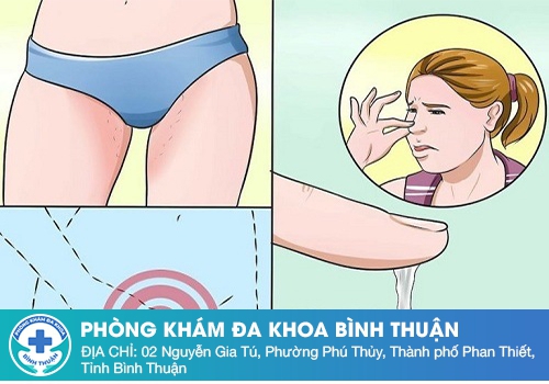 Nguyên nhân gây ra hiện tượng dịch âm đạo trắng sữa