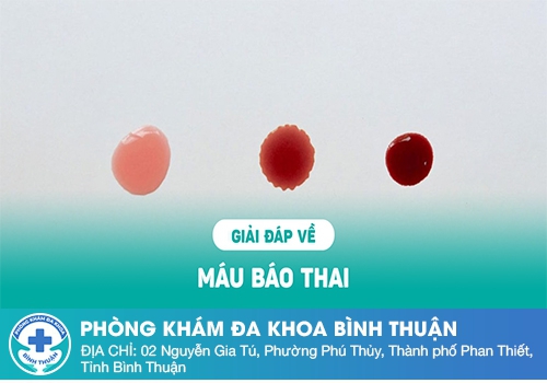 Tìm hiểu chung về máu báo thai