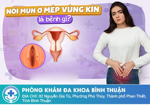 Nổi mụn cứng vùng kín không đau ở nữ giới là bệnh gì?