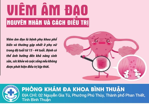 Nguyên nhân dẫn đến nấm phụ khoa