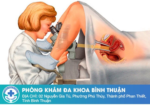 Soi cổ tử cung là gì?