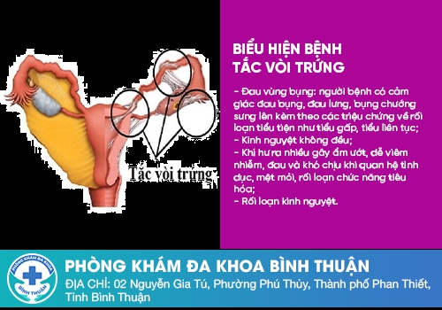 Các bệnh vùng kín nữ giới thường gặp phải 