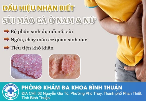 Nổi mụn nước vùng kín do bệnh sùi mào gà