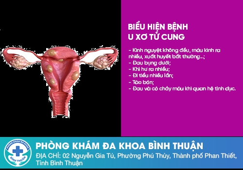 Các bệnh vùng kín nữ giới thường gặp phải