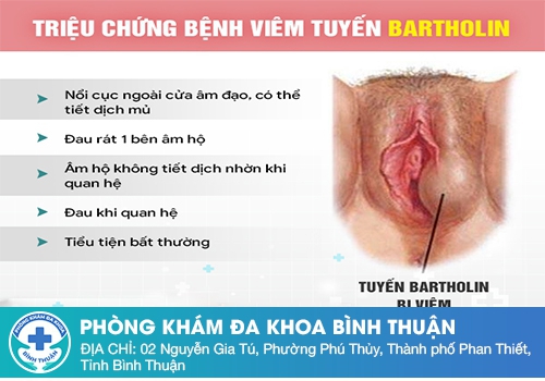 Nổi mụn cứng vùng kín không đau ở nữ giới là bệnh gì?