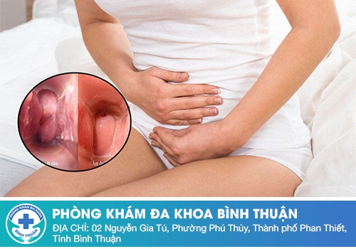 Dấu hiệu chậm kinh có phải do viêm cổ tử cung gây nên hay không?