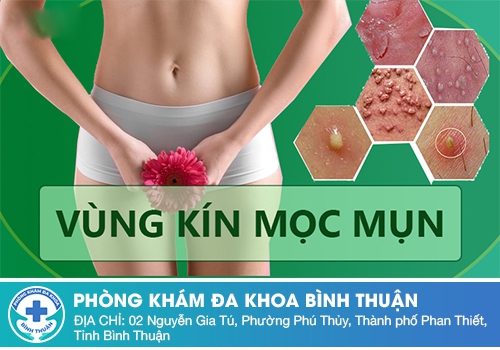 Nổi mụn nước vùng kín ở nữ giới là bị bệnh gì?