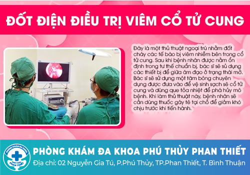 Điều trị viêm lộ tuyến độ 3 thế nào hiệu quả nhất?