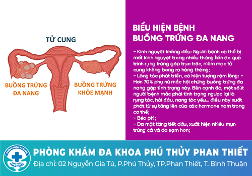 Nguyên nhân dẫn đến tình trạng trễ kinh là gì?