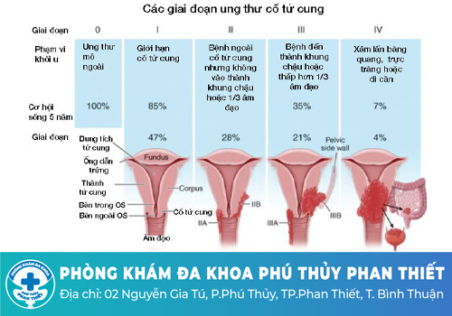 Nổi mụn cứng vùng kín không đau ở nữ giới là bệnh gì?