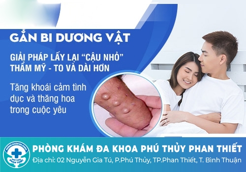 Những lưu ý khi gắn bi dương vật là gì?