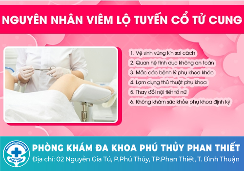 Nguyên nhân viêm lộ tuyến cổ tử cung