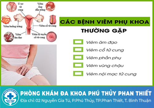 Khi nào nên đi khám phụ khoa?