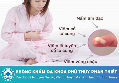 Lợi ích khám phụ khoa