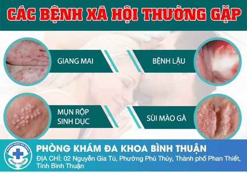 benh-xa-hoi-thuong-gap.jpg