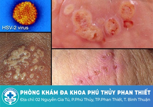 Các bệnh xã hội