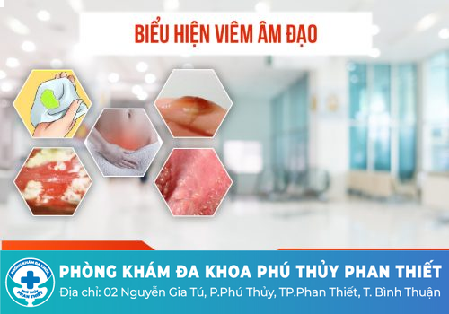 Mọc mụn nước âm đạo viêm phụ khoa